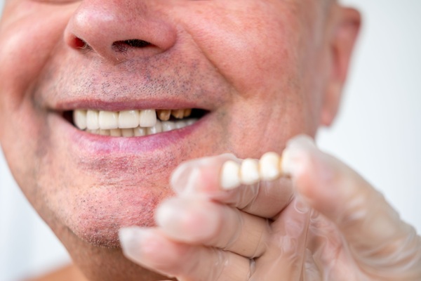 A Guide To All On   Implant Treatment By A Restorative Dentist