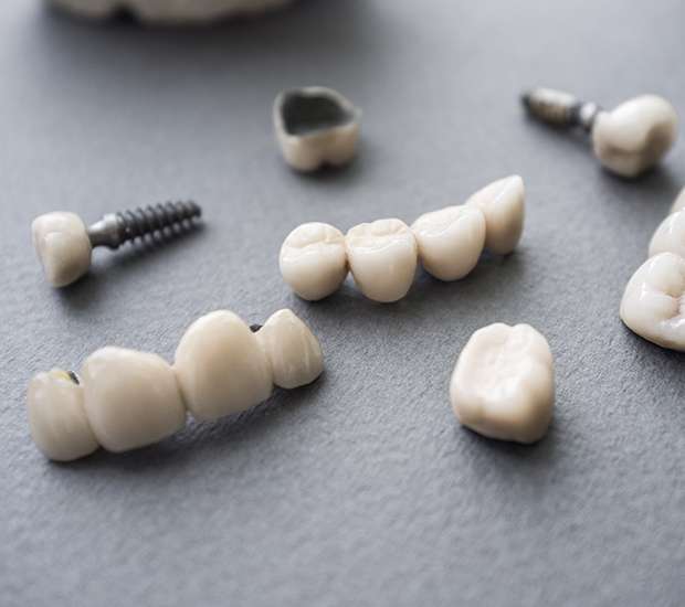 Murfreesboro The Difference Between Dental Implants and Mini Dental Implants