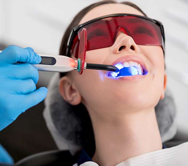 Murfreesboro Professional Teeth Whitening